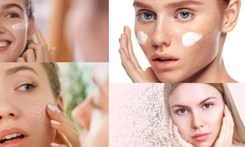 Mustela Nemlendirici Krem Hangi Özelliklere Sahiptir?