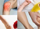 Pes Cavus Nedir?
