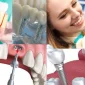 Dental İmplant İle Gülüşünüzü Tasarlıyoruz